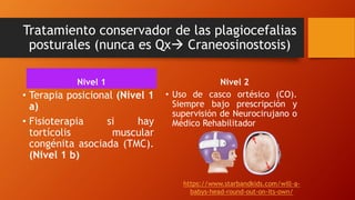 Tratamiento conservador de las plagiocefalias
posturales (nunca es Qx→ Craneosinostosis)
Nivel 1
• Terapia posicional (Nivel 1
a)
• Fisioterapia si hay
tortícolis muscular
congénita asociada (TMC).
(Nivel 1 b)
Nivel 2
• Uso de casco ortésico (CO).
Siempre bajo prescripción y
supervisión de Neurocirujano o
Médico Rehabilitador
https://www.starbandkids.com/will-a-
babys-head-round-out-on-its-own/
 