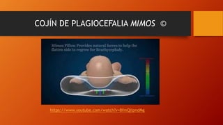 COJÍN DE PLAGIOCEFALIA MIMOS ©
https://www.youtube.com/watch?v=8fmQjlpndMg
 