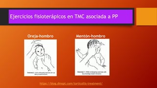 Ejercicios fisioterápicos en TMC asociada a PP
Oreja-hombro Mentón-hombro
https://blog.dinopt.com/torticollis-treatment/
 