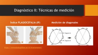 Diagnóstico II: Técnicas de medición
Índice PLAGIOCEFALIA (IP) Medición de diagonales
https://mimosbabypillow.se/nl/kraniometer/
 