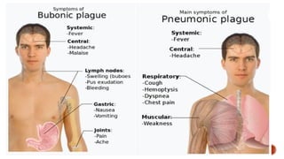 PLAGUE .pptx Septicemic, Bubonic, Pneumonic , MEENA RANA | PPTX