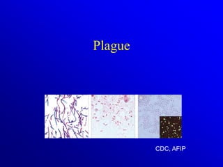 Plague
CDC, AFIP
 