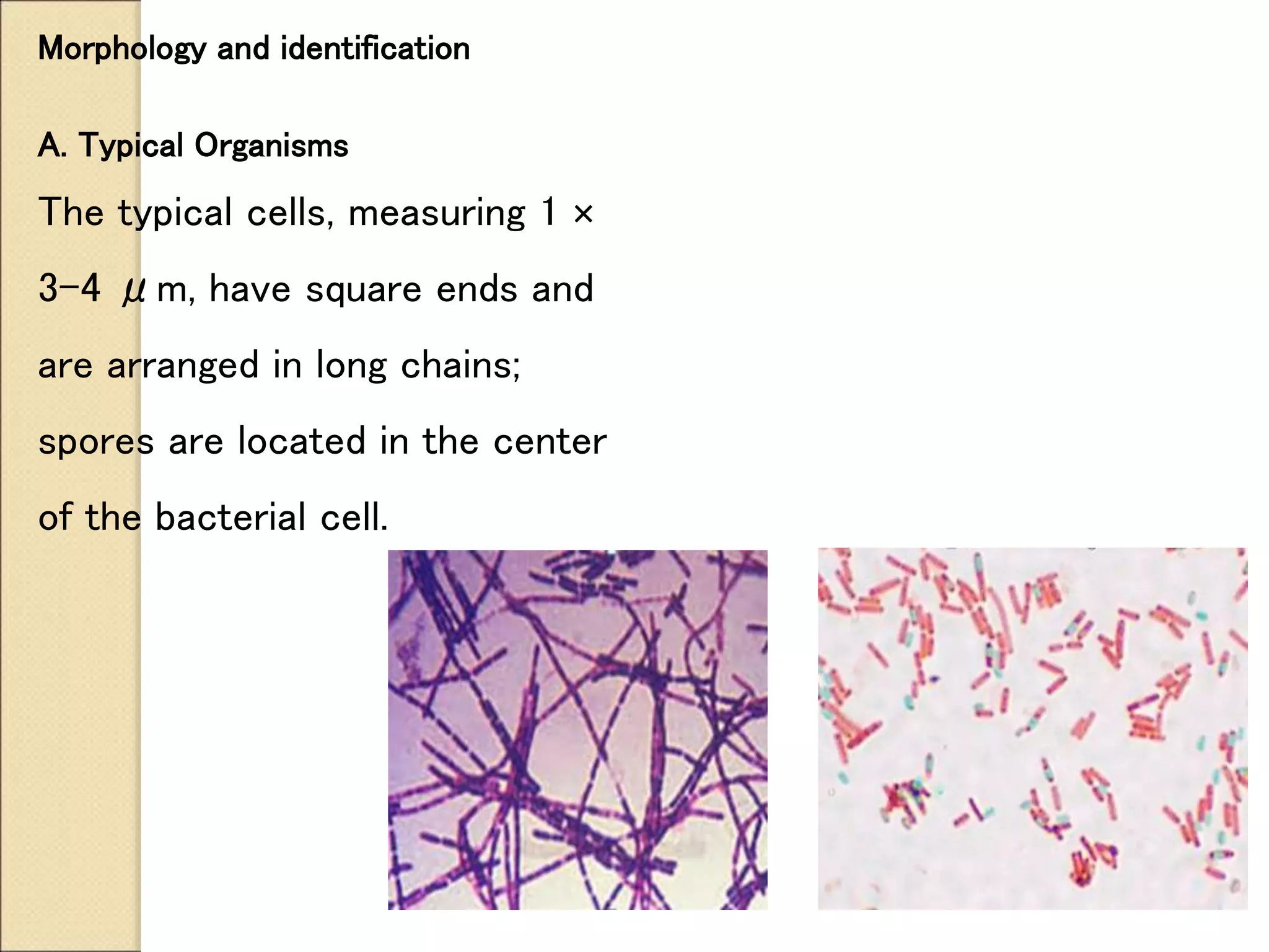 Morphology and identification
A. Typical Organisms
The typical cells, measuring 1 ×
3–4 μm, have square ends and
are arranged in long chains;
spores are located in the center
of the bacterial cell.
 