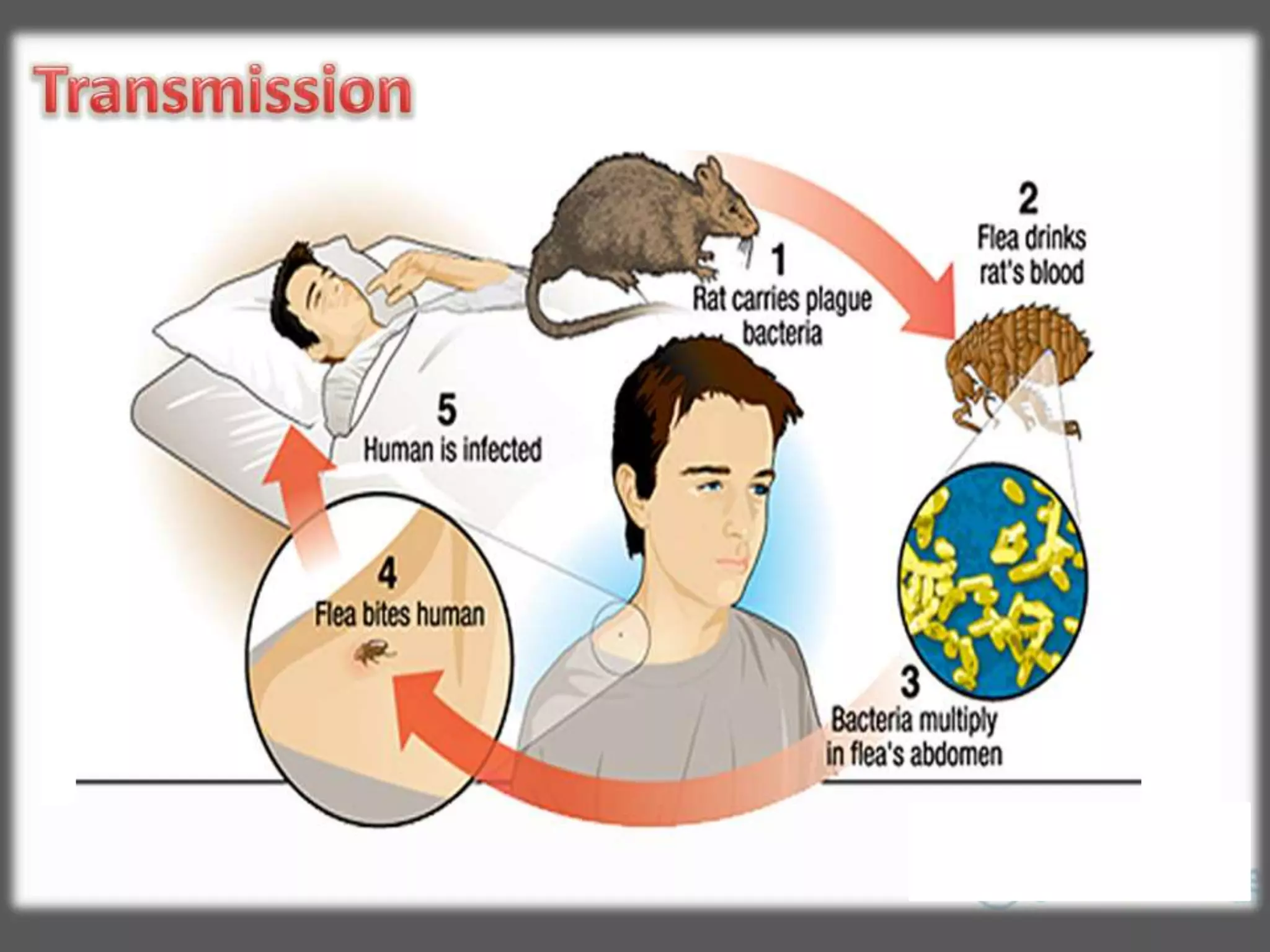 Plague disease