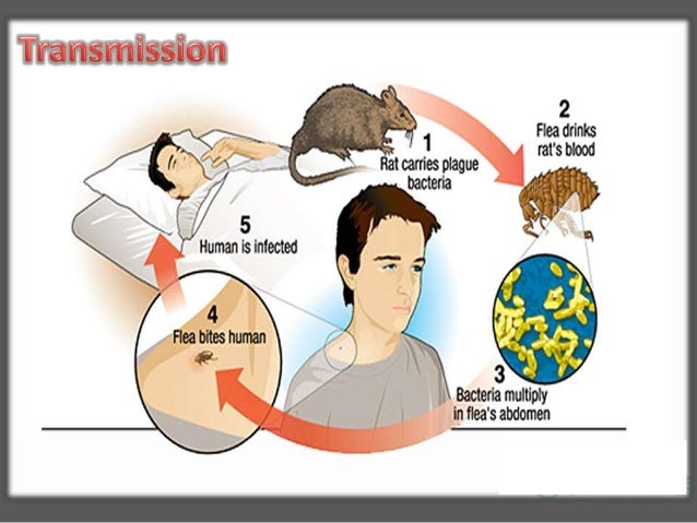 Image result for plague disease