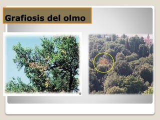 Grafiosis del olmo
 