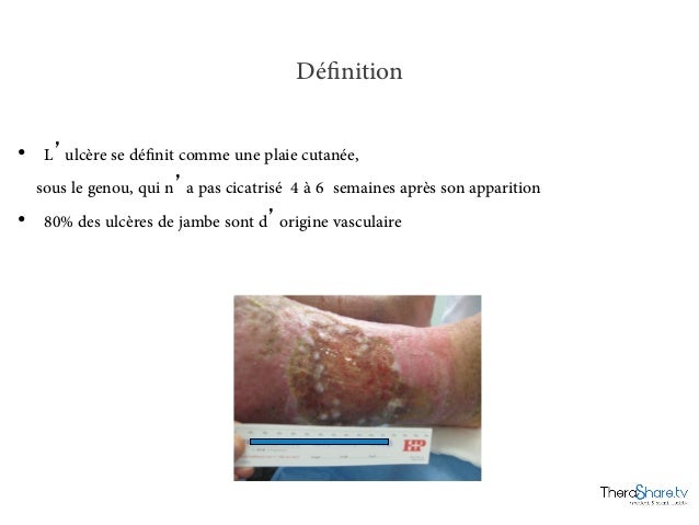 Plaies et cicatrisation : Apprendre à mieux soigner