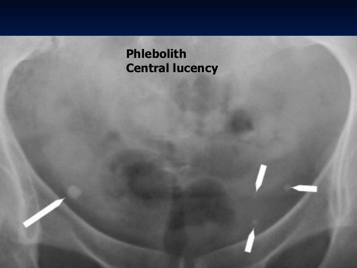 radiology.Plain abd.(dr.kawa)