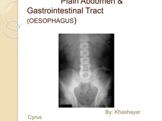 Plain Abdomen &
Gastrointestinal Tract
(OESOPHAGUS)
By: Khashayar
Cyrus
 