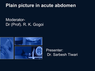 Plain picture in acute abdomen

Moderator-
Dr (Prof). R. K. Gogoi




                         Presenter:
                         Dr. Sarbesh Tiwari
 