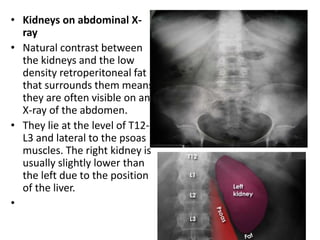 • Kidneys on abdominal X-
ray
• Natural contrast between
the kidneys and the low
density retroperitoneal fat
that surrounds them means
they are often visible on an
X-ray of the abdomen.
• They lie at the level of T12-
L3 and lateral to the psoas
muscles. The right kidney is
usually slightly lower than
the left due to the position
of the liver.
•
 
