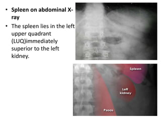 • Spleen on abdominal X-
ray
• The spleen lies in the left
upper quadrant
(LUQ)immediately
superior to the left
kidney.
 