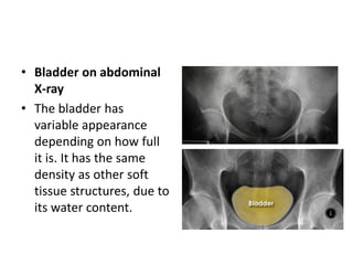 • Bladder on abdominal
X-ray
• The bladder has
variable appearance
depending on how full
it is. It has the same
density as other soft
tissue structures, due to
its water content.
 