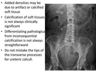 • Added densities may be
due to artifact or calcified
soft tissue
• Calcification of soft tissues
is not always clinically
significant
• Differentiating pathological
from inconsequential
calcification is not always
straightforward
• Do not mistake the tips of
the transverse processes
for ureteric calculi.
 