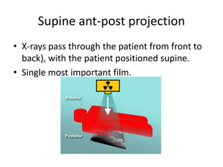 Supine ant-post projection
• X-rays pass through the patient from front to
back), with the patient positioned supine.
• Single most important film.
 