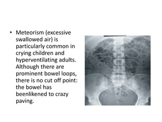 • Meteorism (excessive
swallowed air) is
particularly common in
crying children and
hyperventilating adults.
Although there are
prominent bowel loops,
there is no cut off point:
the bowel has
beenlikened to crazy
paving.
 