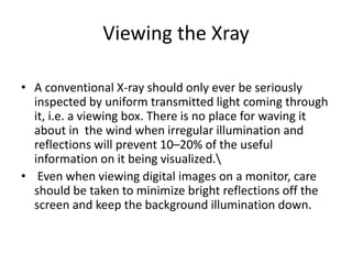 Viewing the Xray
• A conventional X-ray should only ever be seriously
inspected by uniform transmitted light coming through
it, i.e. a viewing box. There is no place for waving it
about in the wind when irregular illumination and
reflections will prevent 10–20% of the useful
information on it being visualized.
• Even when viewing digital images on a monitor, care
should be taken to minimize bright reflections off the
screen and keep the background illumination down.
 