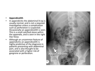 • Appendicolith
• In appendicitis the abdominal X-ray is
usually normal, and is not a required
investigation unless a complication
such as perforation is suspected.
Occasionally an appendicolith is seen.
This is a small calcified stone within
the appendix, and is seen in the right
iliac fossa.
• Although an uncommon feature of
appendicitis an appendicolith is
highly predictive of the diagnosis in
patients presenting with abdominal
pain, and is also thought to be
associated with a higher risk of
gangrene or perforation.
 
