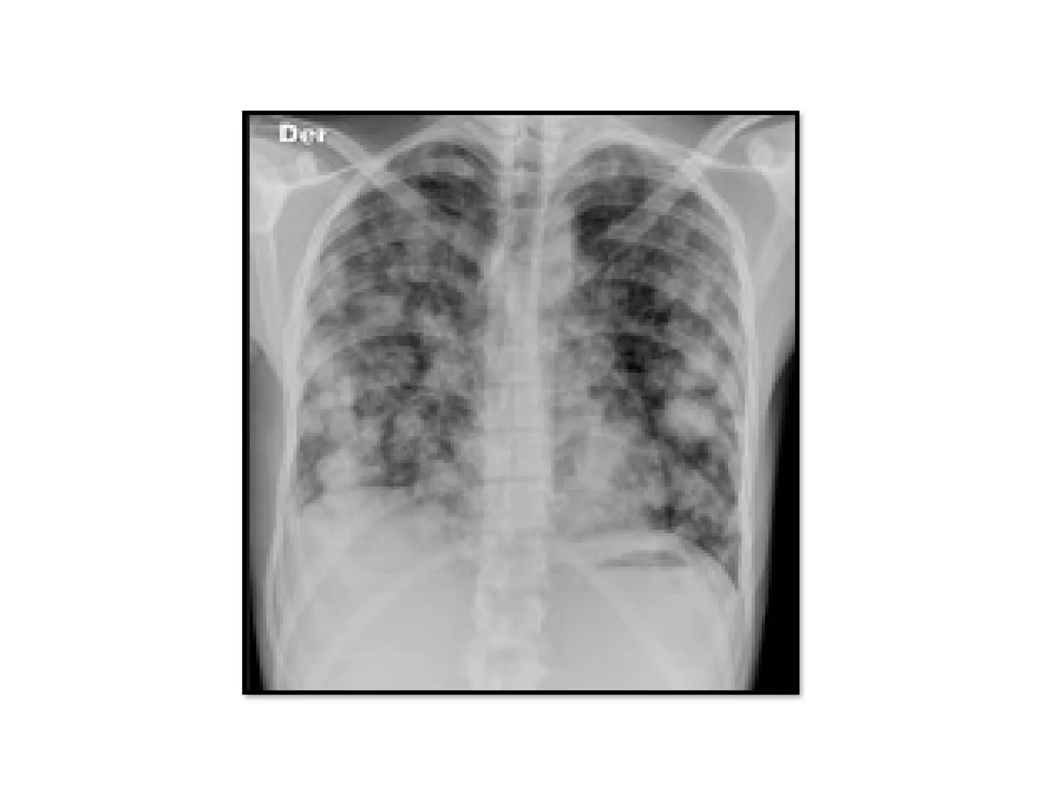 Plain radiological films surgery pdf pptx