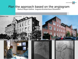 Plan the approach based on the angiogram
Markus Meyer-Geßner Augusta-Krankenhaus Düsseldorf
 