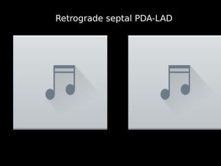11
Retrograde septal PDA-LAD