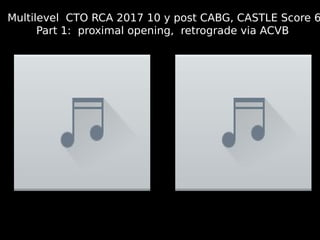 14
Multilevel CTO RCA 2017 10 y post CABG, CASTLE Score 6
Part 1: proximal opening, retrograde via ACVB