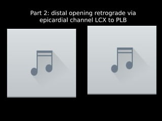 15
Part 2: distal opening retrograde via
epicardial channel LCX to PLB