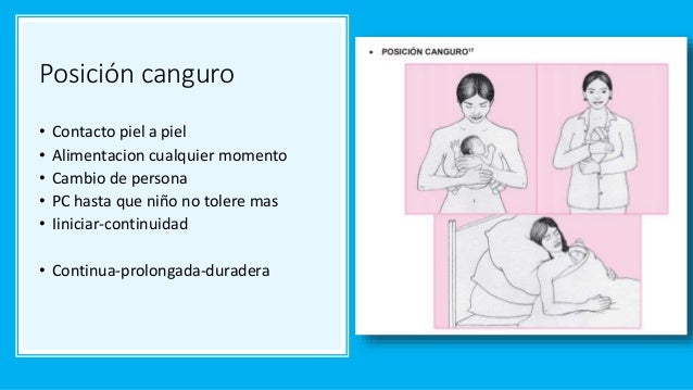 Método colombiano "Madre canguro" MMC