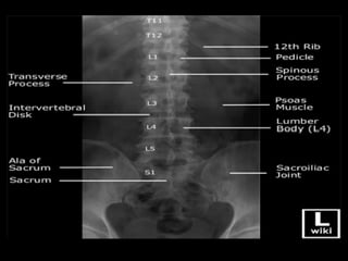 Planchage_radiologie_ostéo_articulaire_10_rachisFFFFFFFFFFFFFFFFFFF.pdf