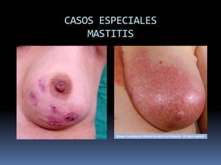 Comodidad.BUENA POSICIONLa cabeza y el cuerpo están en línea recta.La cara mira hacia el pecho.La madre mantiene el cuerpo del bebé cerca.La madre lo envuelve en un abrazo. 