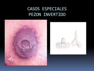 BUEN AGARREMentón y la nariz están cerca del pecho.Labios están evertidos, sobretodo el inferior.La boca del bebé está bien abierta.Se observa más areola por encima de la boca del bebé que por debajo 