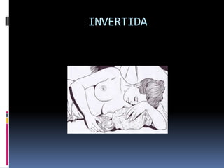 AGARRE
