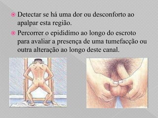  Detectar  se há uma dor ou desconforto ao
  apalpar esta região.
 Percorrer o epididímo ao longo do escroto
  para avaliar a presença de uma tumefacção ou
  outra alteração ao longo deste canal.
 