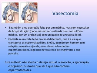 Vasectomia
•  É também uma operação feita por um médico, mas sem necessitar 
de hospitalização (pode mesmo ser realizada num consultório 
médico, por um urologista) com utilização de anestesia local. 
• Consiste num corte feito no canal deferente, que é a via que 
transporta os espermatozóides. Então, quando um homem tem 
relações sexuais e ejacula, esse sémen não contem 
espermatozóides, logo não haverá risco de engravidar a sua 
parceira. 
Este método não afecta o desejo sexual, a erecção, a ejaculação, 
o orgasmo: o sémen que sai é que não contém 
espermatozóides. 
 