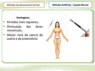 Métodos de planeamento familiar   Métodos Artificiais – Injeção Mensal




          Vantagens:
• Períodos mais regulares;
• Diminuição     das   dores
  menstruais;
• Menor risco do cancro do
  ovário e do endométrio.
 