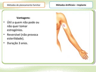 Métodos de planeamento familiar   Métodos Artificiais – Implante




          Vantagens:
• Útil a quem não pode ou
  não quer tomar
  estrogénios.
• Reversível (não provoca
  esterilidade).
• Duração 3 anos.
 