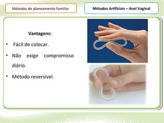 Métodos de planeamento familiar   Métodos Artificiais – Anel Vaginal




              Vantagens:

•   Fácil de colocar.
• Não         exige   compromisso
    diário.
• Método reversível.
 