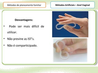 Métodos de planeamento familiar   Métodos Artificiais – Anel Vaginal




          Desvantagens:

•    Pode ser mais difícil de
    utilizar.
• Não previne as IST’s.

• Não é comparticipado.
 