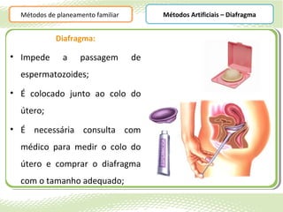 Métodos de planeamento familiar        Métodos Artificiais – Diafragma


             Diafragma:

• Impede       a    passagem        de
  espermatozoides;
• É colocado junto ao colo do
  útero;
• É necessária consulta com
  médico para medir o colo do
  útero e comprar o diafragma
  com o tamanho adequado;
 