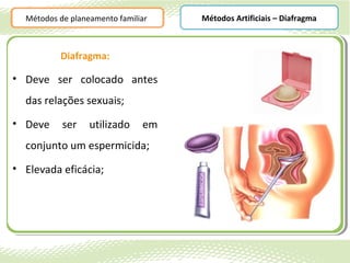 Métodos de planeamento familiar   Métodos Artificiais – Diafragma



          Diafragma:

• Deve ser colocado antes
  das relações sexuais;
• Deve     ser    utilizado    em
  conjunto um espermicida;
• Elevada eficácia;
 
