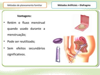 Métodos de planeamento familiar   Métodos Artificiais – Diafragma



          Vantagens:

• Retém o fluxo menstrual
  quando usado durante a
  menstruação;
• Pode ser reutilizado;

• Sem efeitos secundários
  significativos.
 