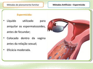 Métodos de planeamento familiar          Métodos Artificiais – Espermicida



            Espermicida:

• Líquido        utilizado          para
  aniquilar os espermatozoides,
  antes de fecundar;
• Colocado dentro da vagina
  antes da relação sexual;
• Eficácia moderada.
 