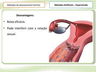 Métodos de planeamento familiar   Métodos Artificiais – Espermicida



            Desvantagens:

• Baixa eficácia.

• Pode interferir com a relação
  sexual.
 