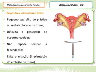 Métodos de planeamento familiar        Métodos Artificiais – DIU


  Dispositivo intra-uterino (DIU):

• Pequeno aparelho de plástico
  ou metal colocado no útero;
• Dificulta    a    passagem        de
  espermatozoides;
• Não      impede       sempre       a
  fecundação;
• Evita a nidação (implantação
  do embrião no útero);
 