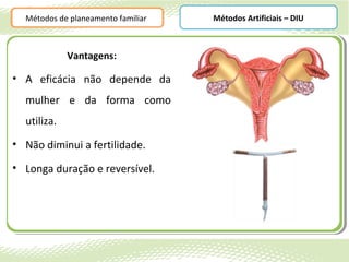Métodos de planeamento familiar   Métodos Artificiais – DIU



             Vantagens:

• A eficácia não depende da
  mulher e da forma como
  utiliza.
• Não diminui a fertilidade.

• Longa duração e reversível.
 