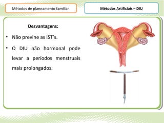 Métodos de planeamento familiar   Métodos Artificiais – DIU



          Desvantagens:

• Não previne as IST’s.

• O DIU não hormonal pode
  levar a períodos menstruais
  mais prolongados.
 