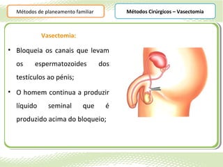 Métodos de planeamento familiar         Métodos Cirúrgicos – Vasectomia



            Vasectomia:

• Bloqueia os canais que levam
  os     espermatozoides            dos
  testículos ao pénis;
• O homem continua a produzir
  líquido     seminal       que      é
  produzido acima do bloqueio;
 