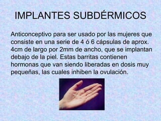 IMPLANTES SUBDÉRMICOS Anticonceptivo para ser usado por las mujeres que consiste en una serie de 4 ó 6 cápsulas de aprox. 4cm de largo por 2mm de ancho, que se implantan debajo de la piel. Estas barritas contienen hormonas que van siendo liberadas en dosis muy pequeñas, las cuales inhiben la ovulación. 