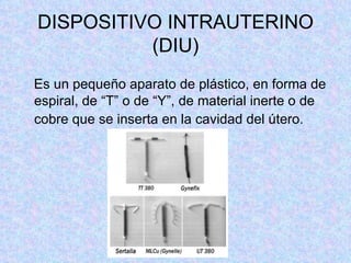 DISPOSITIVO INTRAUTERINO (DIU) Es un pequeño aparato de plástico, en forma de espiral, de “T” o de “Y”, de material inerte o de cobre que se inserta en la cavidad del útero.   