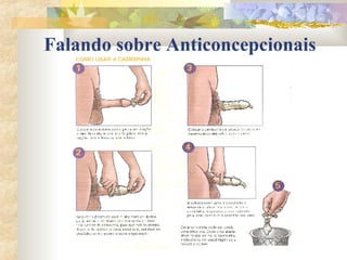 Falando sobre Anticoncepcionais 